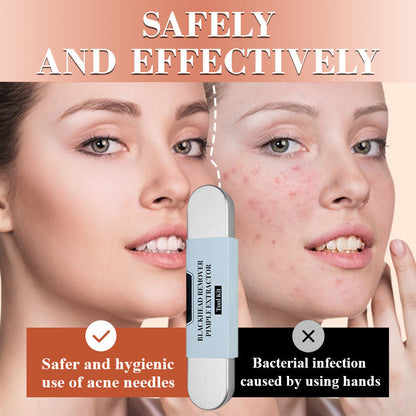 Sale 50% Off 🔥Theflame™ Medical Grade Blackhead Cell Clip Tool Set🛍️