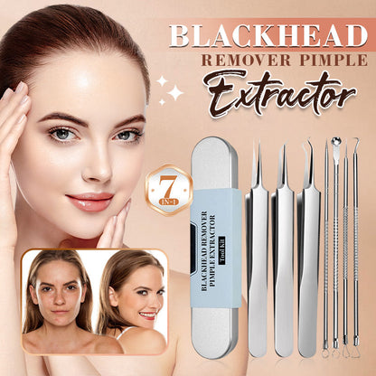 Sale 50% Off 🔥Theflame™ Medical Grade Blackhead Cell Clip Tool Set🛍️